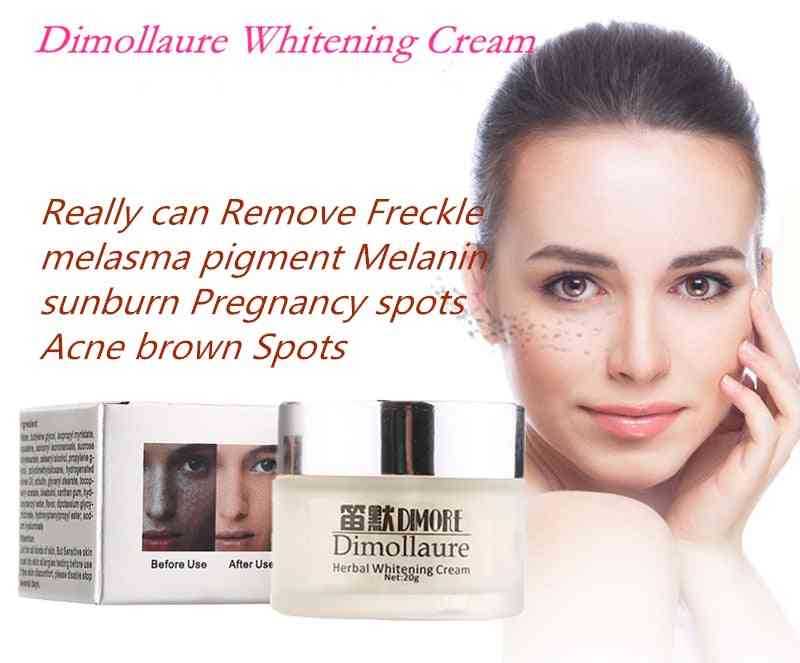 Strong Effect Whitening Cream, Remove Freckle Melasma Pigment Melanin Sunburn Acne Brown Spot