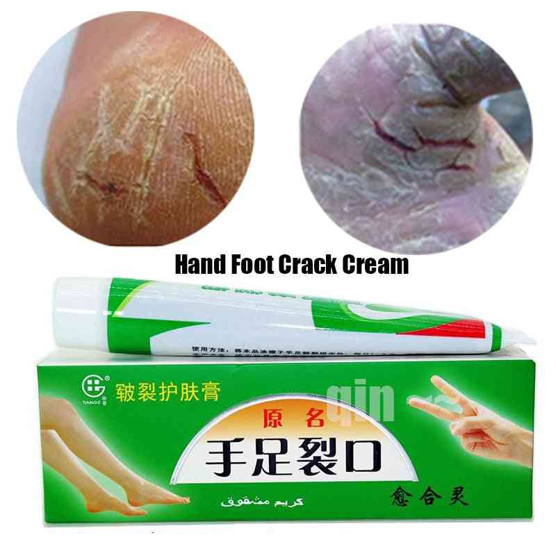 Anti Dry Crack Ointment - Exfoliating Hand, Foot Cream