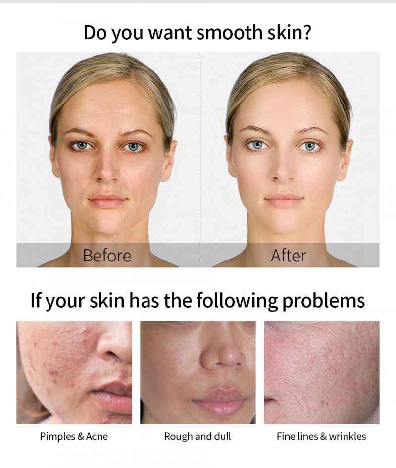 Crema viso idratante sbiancante idratare - siero di lumaca anti rughe, anti invecchiamento viso restringere i pori viso cura della pelle -