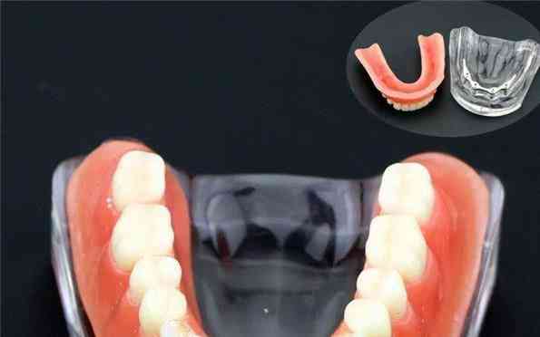Overdenture-hampaiden malli kultaisella palkkahampaiden opetuksella ja tutkimuksella