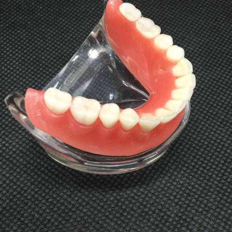 модел на долночелюстни долни зъби със зъб за възстановяване на импланта