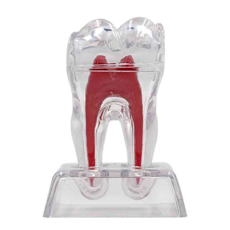 Modelo de dentes rígidos de base dentária de 1 unidade - modelo molar de dente destacável, presente com formato de dentes separáveis para estudo de ensino odontológico
