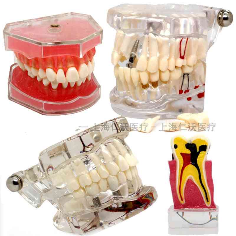 Diverse modele dentare dentare pentru predare