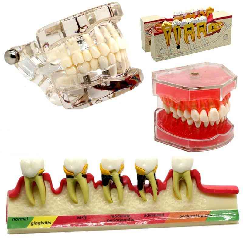 Various Dental Teeth Models For Teaching
