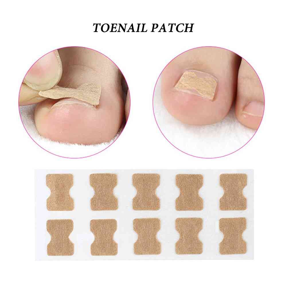 Ingrown Toenail Corrector Sticker - Paronychia Treatment Fixer,  Recover , Corrector Pedicure Foot , Toe , Nail Care Tool