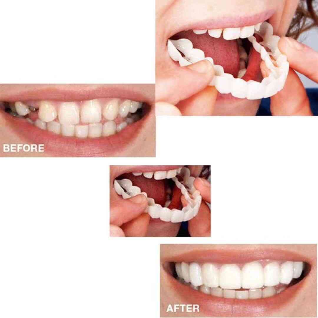 Ylemmät ja alemmat hampaat täydelliset hymyviilut mukavuus sovittaa joustavat hammasproteesiliittimet kaksinkertaiseen valkaisuriviin