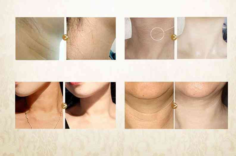 Blanqueamiento hidratante nutritivo reafirmante mascarilla para el cuello crema para el cuidado de la piel