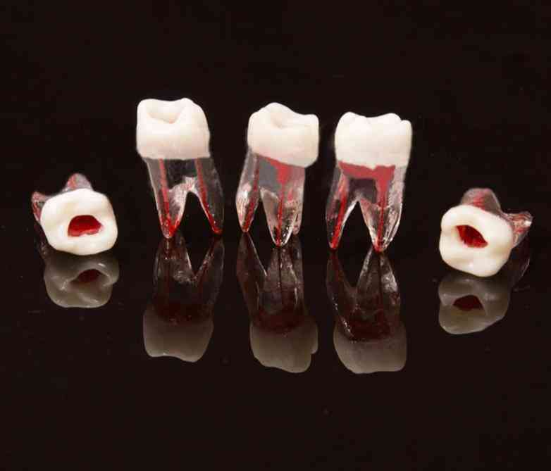 Dental Tooth Root Canal Model For Rct Practice Dentistry Lab Material