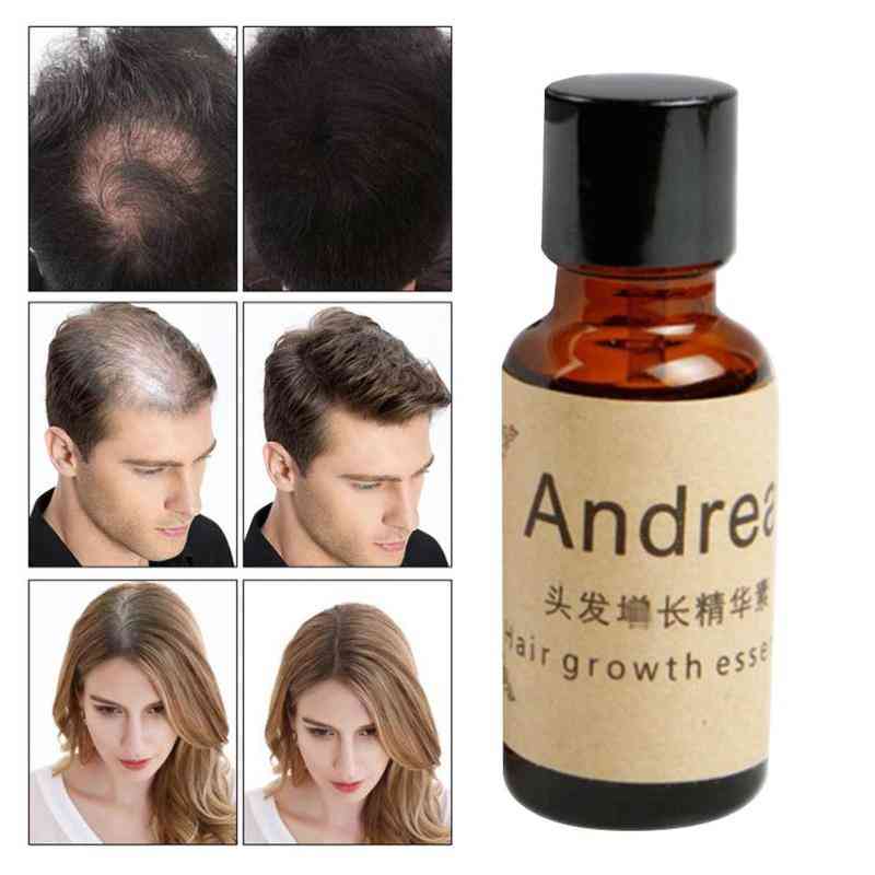 Rapida crescita dei capelli essenzialmente a base di erbe cheratina andrea alopecia liquido per la perditalope