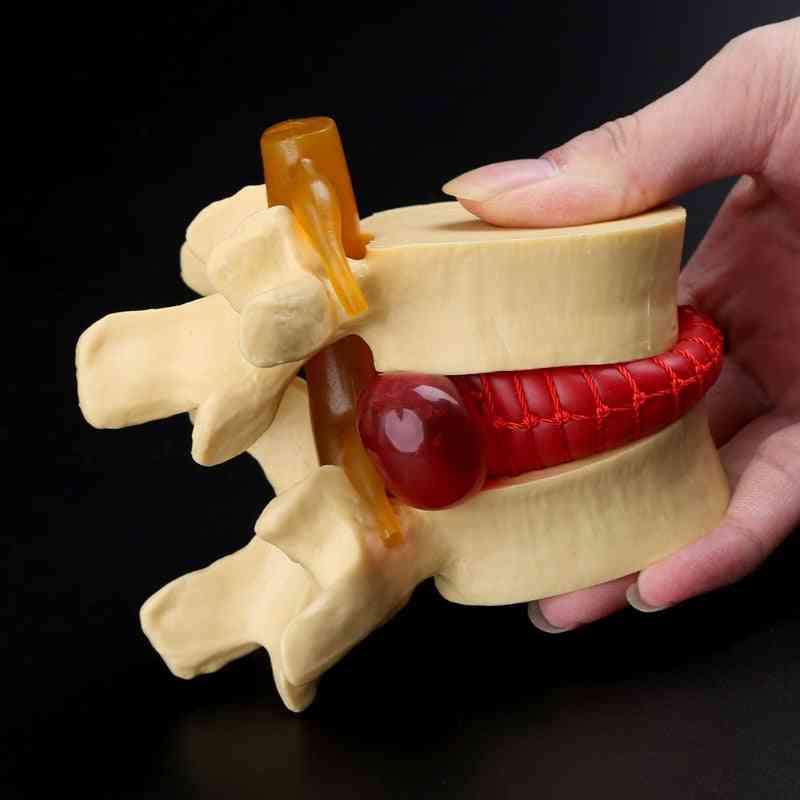 Lekárske rekvizity model bezplatné poštovné anatomický chrbtový bedrový kotúč