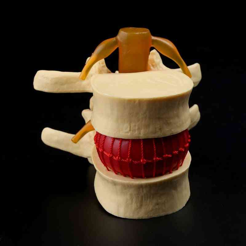 Lekárske rekvizity model bezplatné poštovné anatomický chrbtový bedrový kotúč
