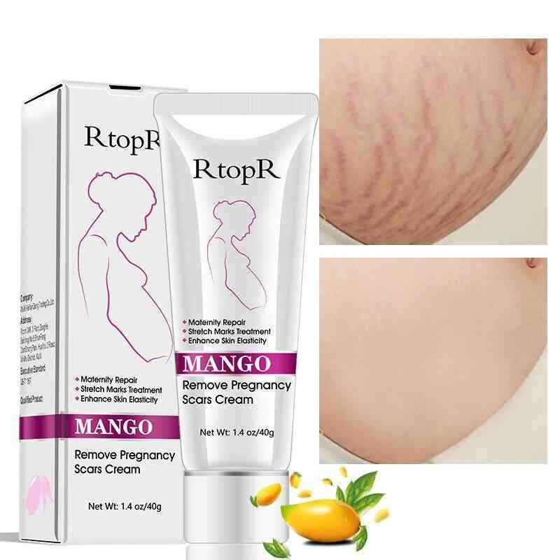 Pregnancy- Scar Removal Cream