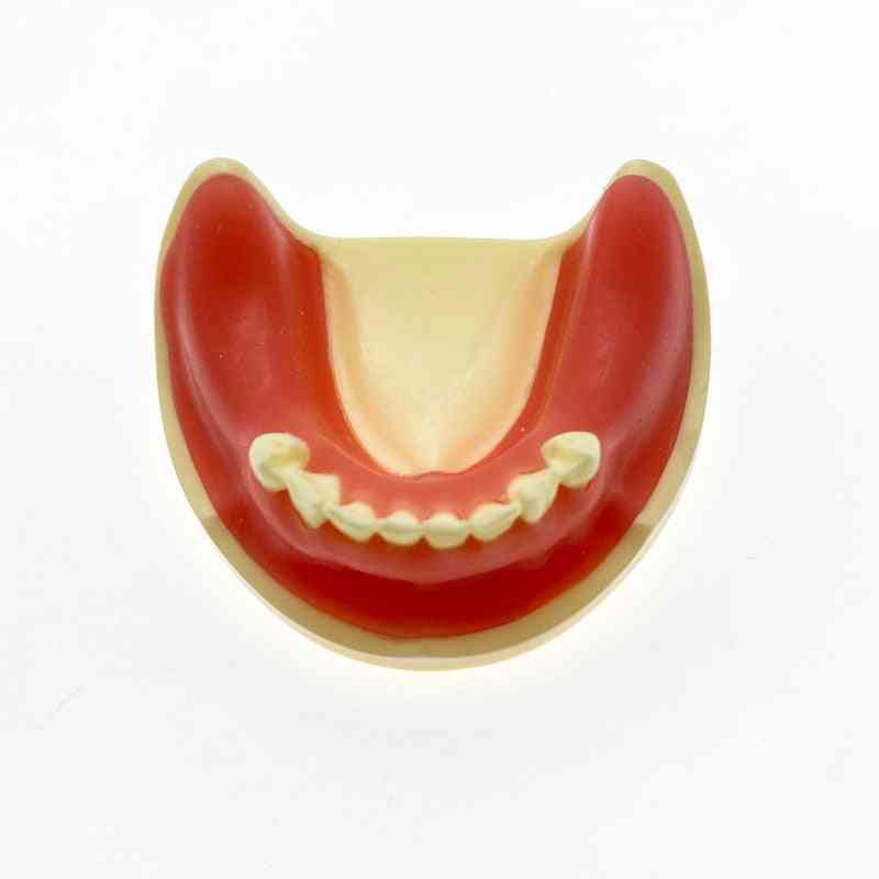 Teeth Model Dental Implant Model For Incision
