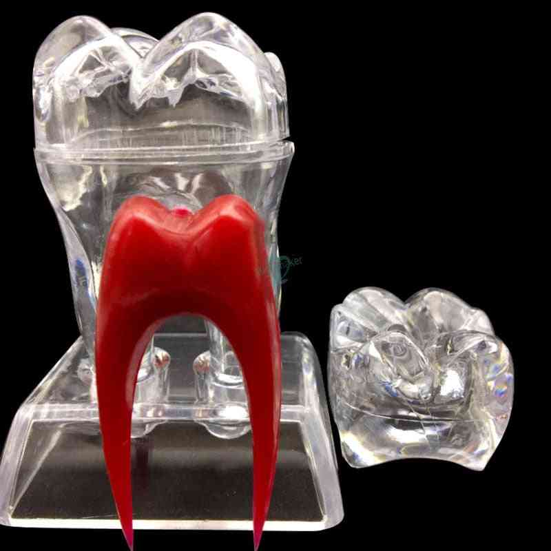 Dental 4 Times Crystal Base Hard Plastic Teeth Tooth