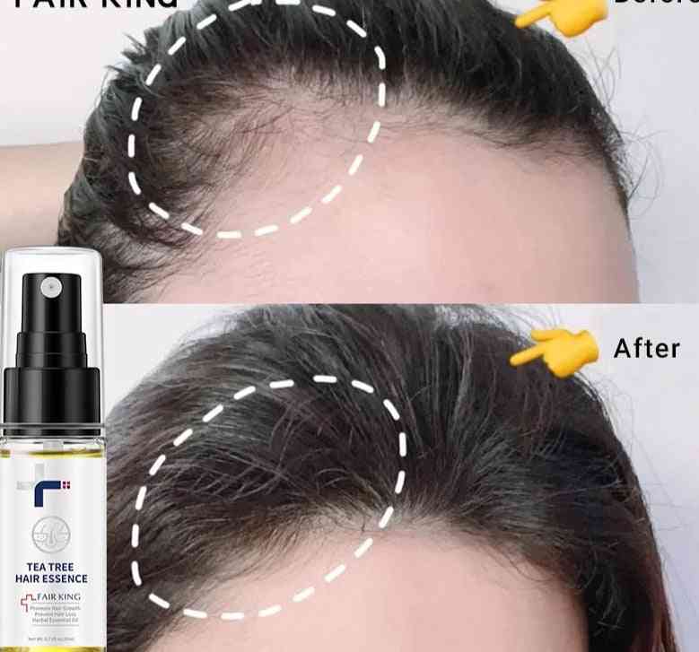 Tea Tree Hair Growth Essence Hair Loss Products Essential Oil
