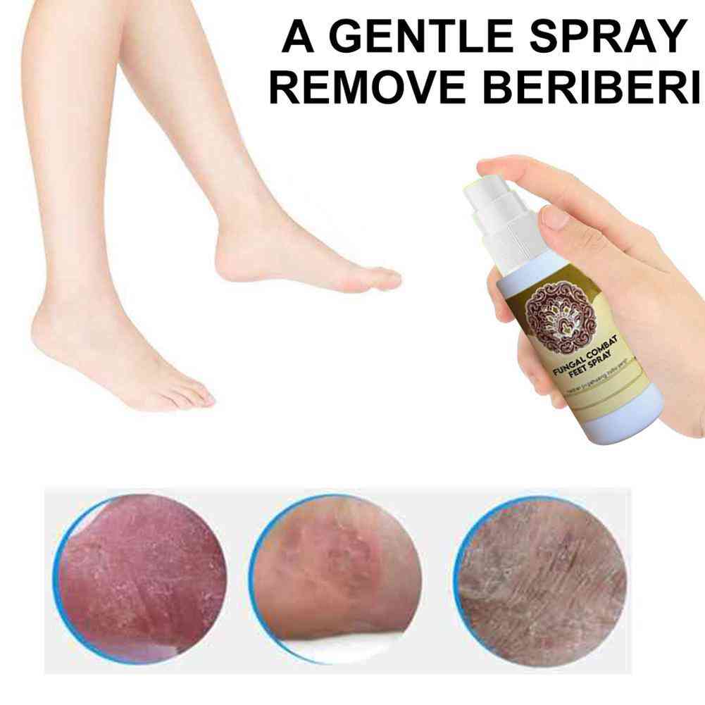 Fungal Combat Feet Spray Foot Sterilize Spray